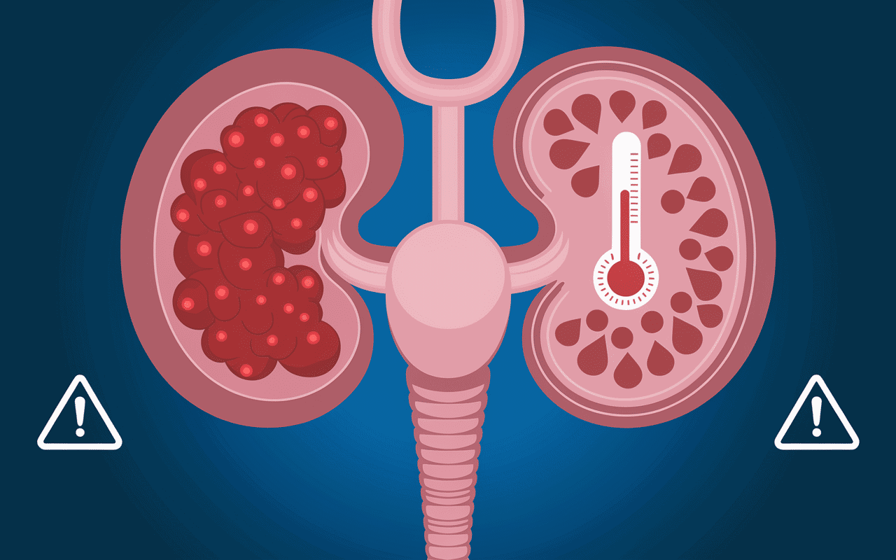 Diagramme illustrant les dangers liés à la vésicule biliaire